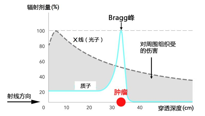 揭秘肿瘤治疗新利器——盘点质子放射治疗的四大优势