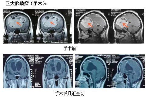 神经外科-伽玛刀科(图2)