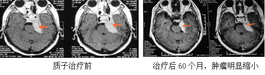 神经外科-伽玛刀科(图7)