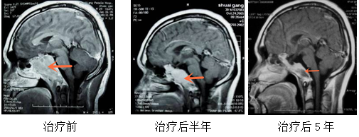 神经外科-伽玛刀科(图5)