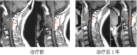 神经外科-伽玛刀科(图6)