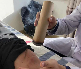 老年病科一病区三九灸开始了！(图2)