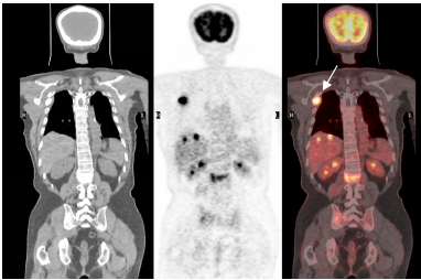 四维PET-CT(图3)