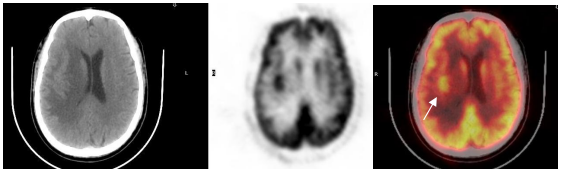 四维PET-CT(图4)