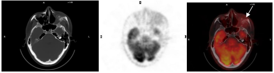 四维PET-CT(图6)