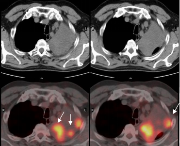 四维PET-CT(图7)