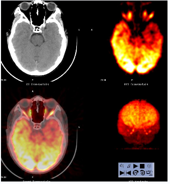 四维PET-CT(图7)