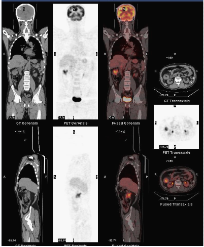 四维PET-CT(图10)