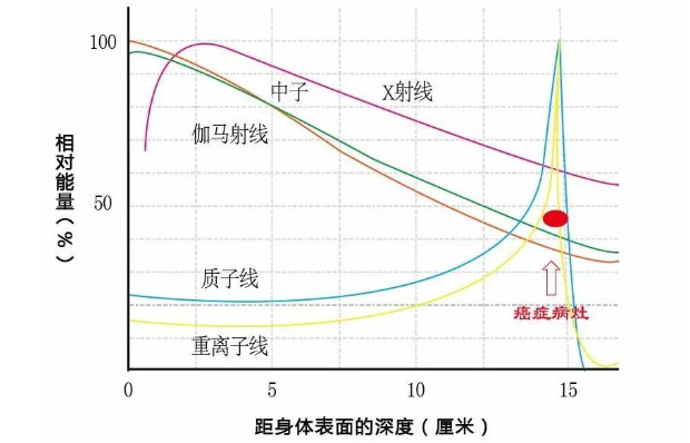 质子治疗：高科技化解脊索瘤治疗难题